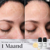 Medik8 Oxy-R Peptides 2x 10ml résultat avant et après