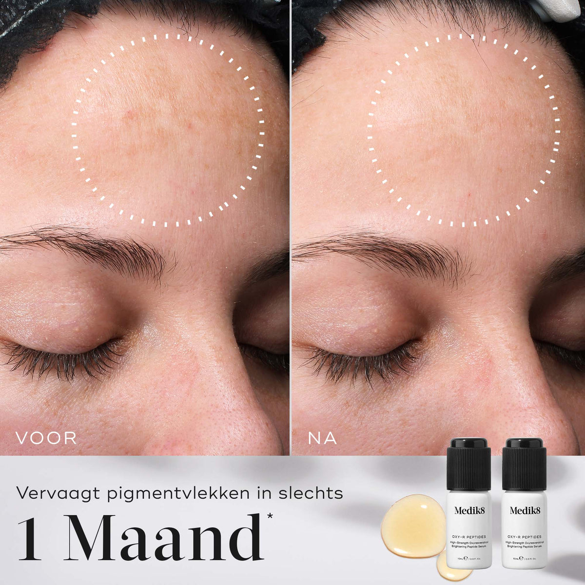 Medik8 Oxy-R Peptides 2x 10ml résultat avant et après