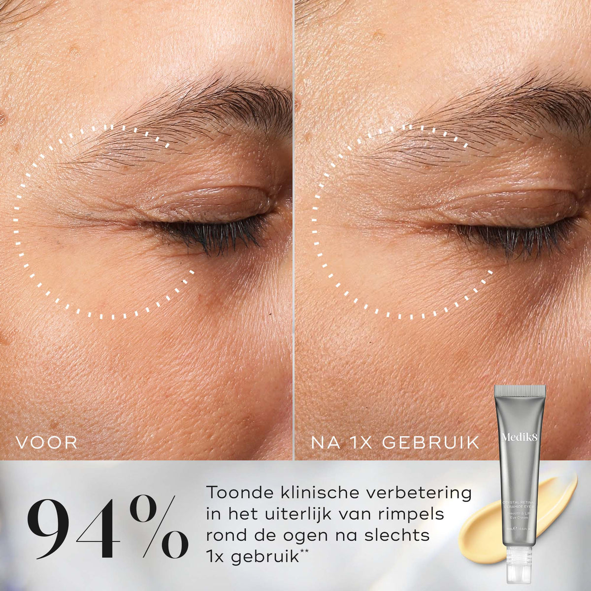 Medik8 Crystal Retinal Ceramide Eye 10 15ml résultat avant et après