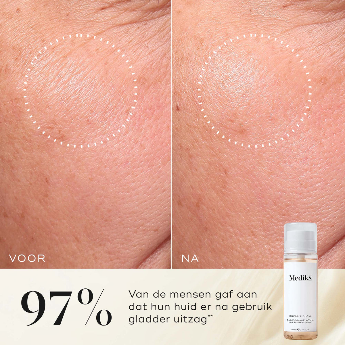 Medik8 Press & Glow Refill 200ml résultat avant et après