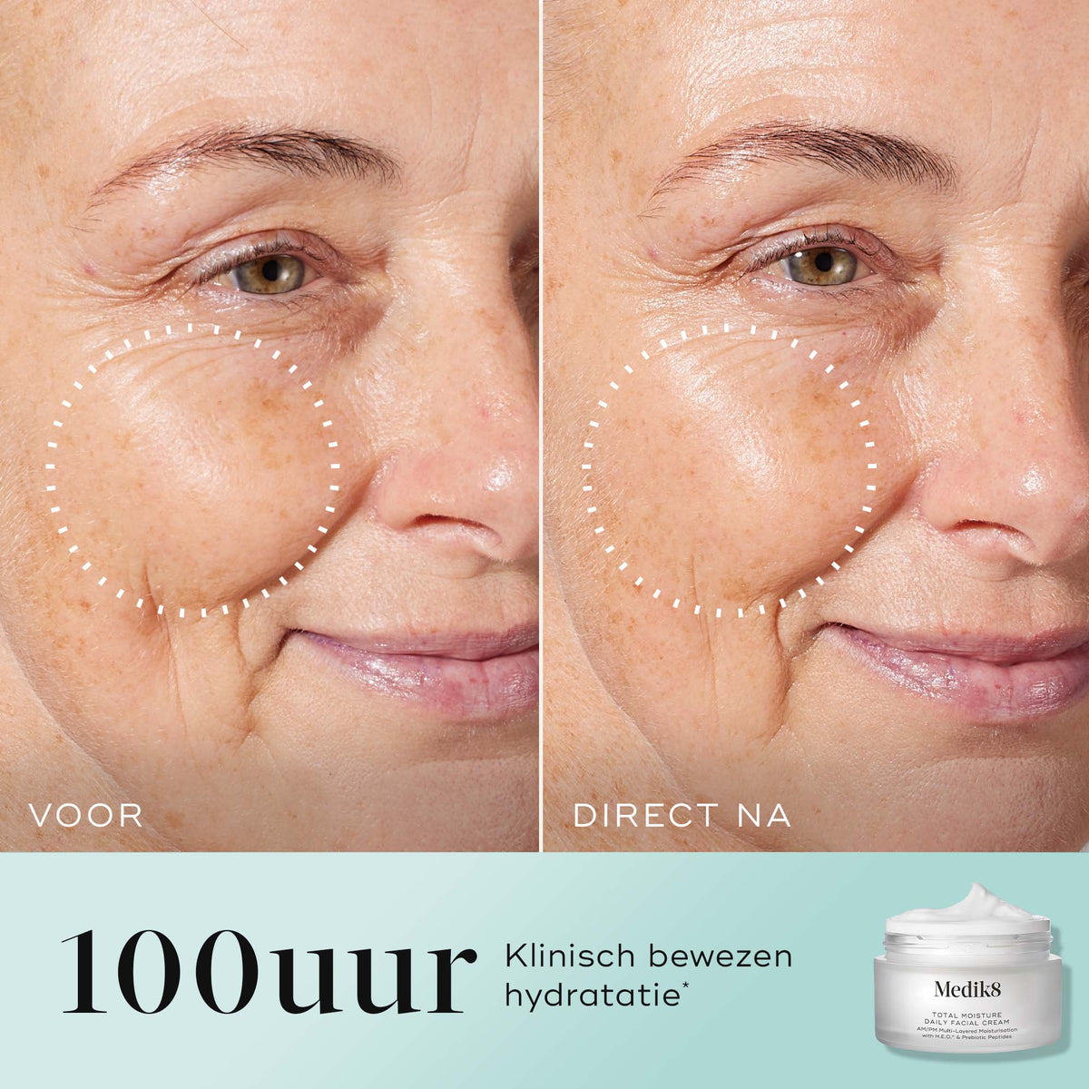 Medik8 Total Moisture Daily Facial Cream 50ml résultat avant et après
