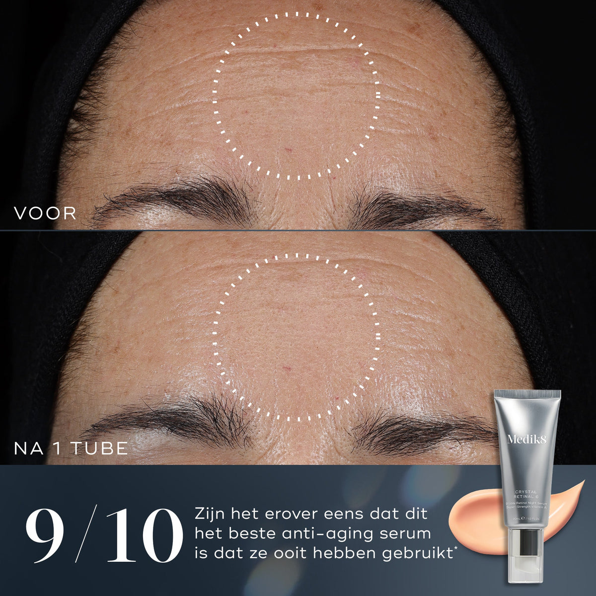 Medik8 Crystal Retinal 1 30ml résultat avant et après deux