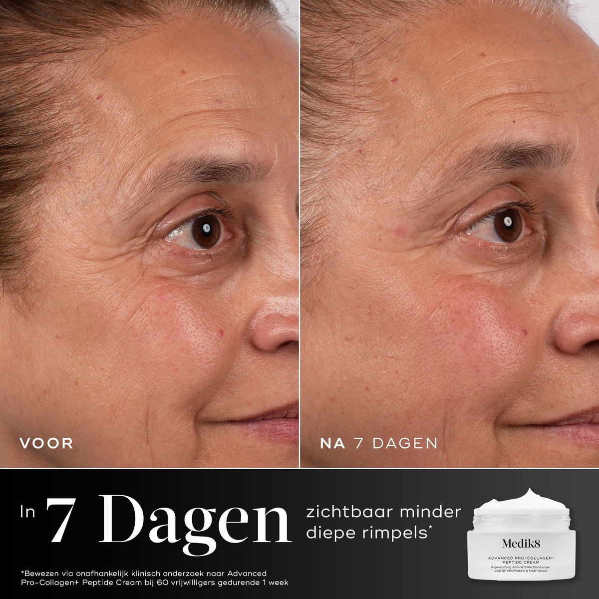 Medik8 Advanced Pro Collagen+ Peptide Cream 50ml résultat avant et après