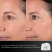 Medik8 Advanced Pro Collagen+ Peptide Cream 50ml résultat avant et après deux