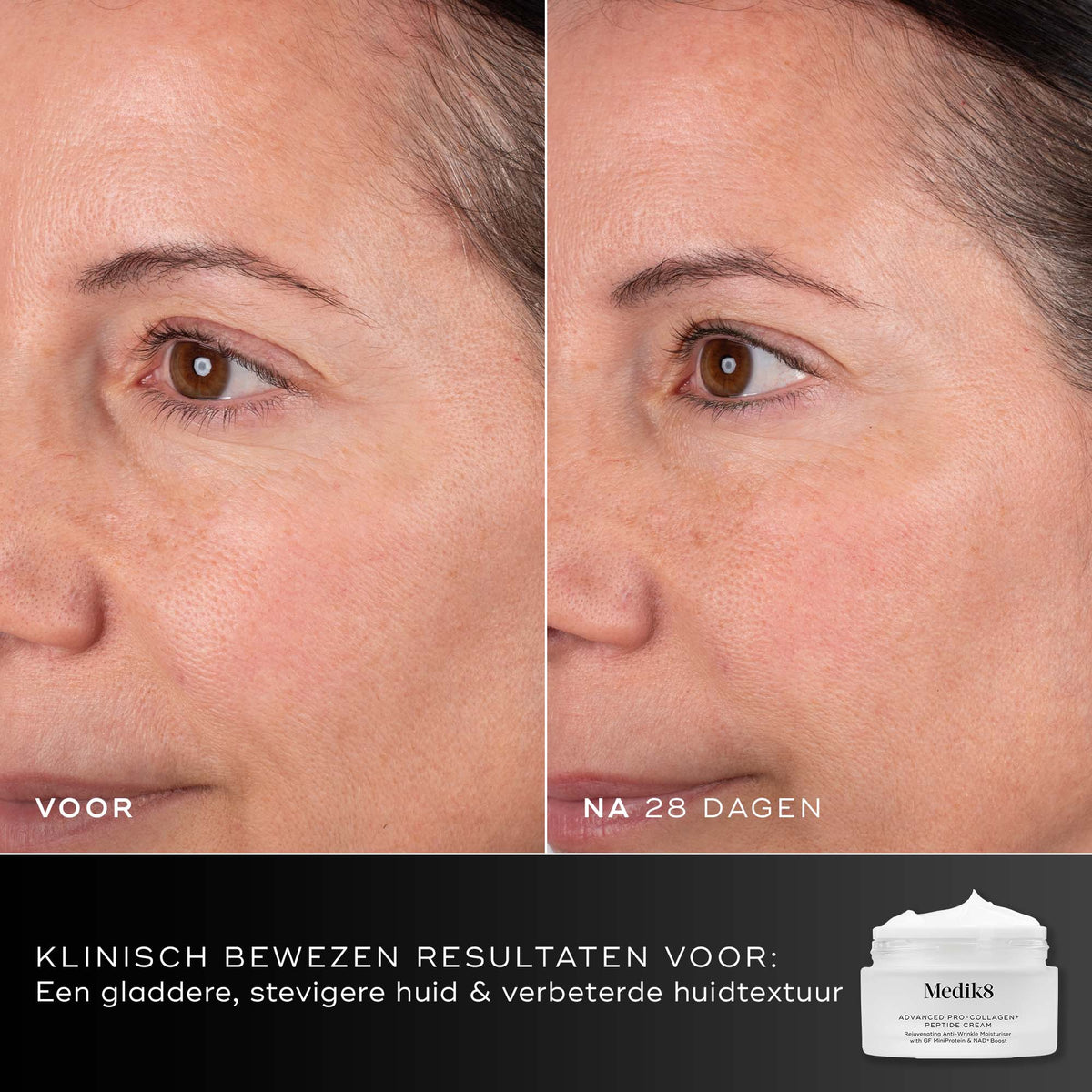 Medik8 Advanced Pro Collagen+ Peptide Cream 50ml résultat avant et après deux