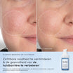Medik8 Niacinamide peptides 30ml résultat avant et après