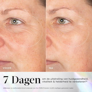 Medik8 Exo-PDRN Prismatic+ 30ml résultat avant et après deux