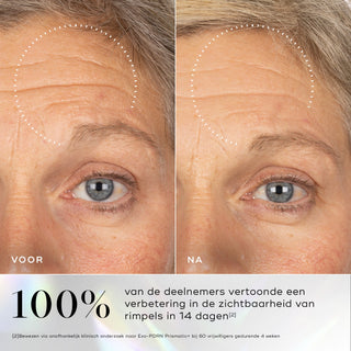 Medik8 Exo-PDRN Prismatic+ 30ml résultat avant et après