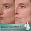Medik8 Total Moisture Cleansing Gel 145ml résultat avant et après