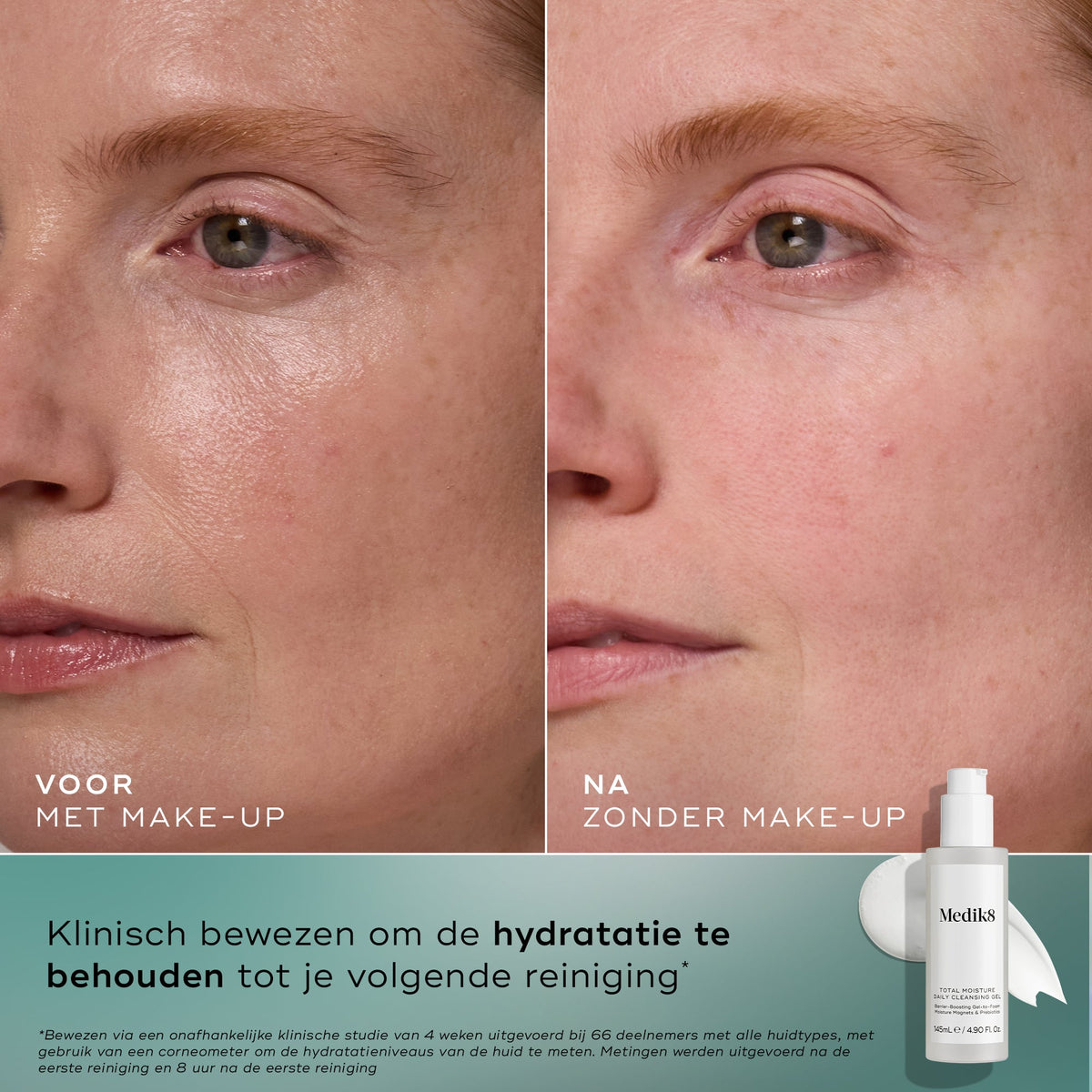 Medik8 Total Moisture Cleansing Gel 145ml résultat avant et après