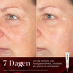 Medik8 Rejuvenation Routine Exo-PDRN Prismatic+ résultat avant et après