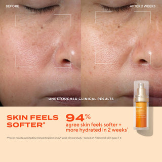 Vita-C Glycolic Serum 30ml | Murad