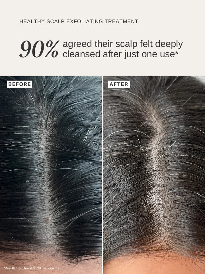 Alpha-H Healthy Scalp Exfoliating Treatment ambiance