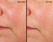 Comfort Zone Skin Regimen Lx Longevity Collagen Serum before en after