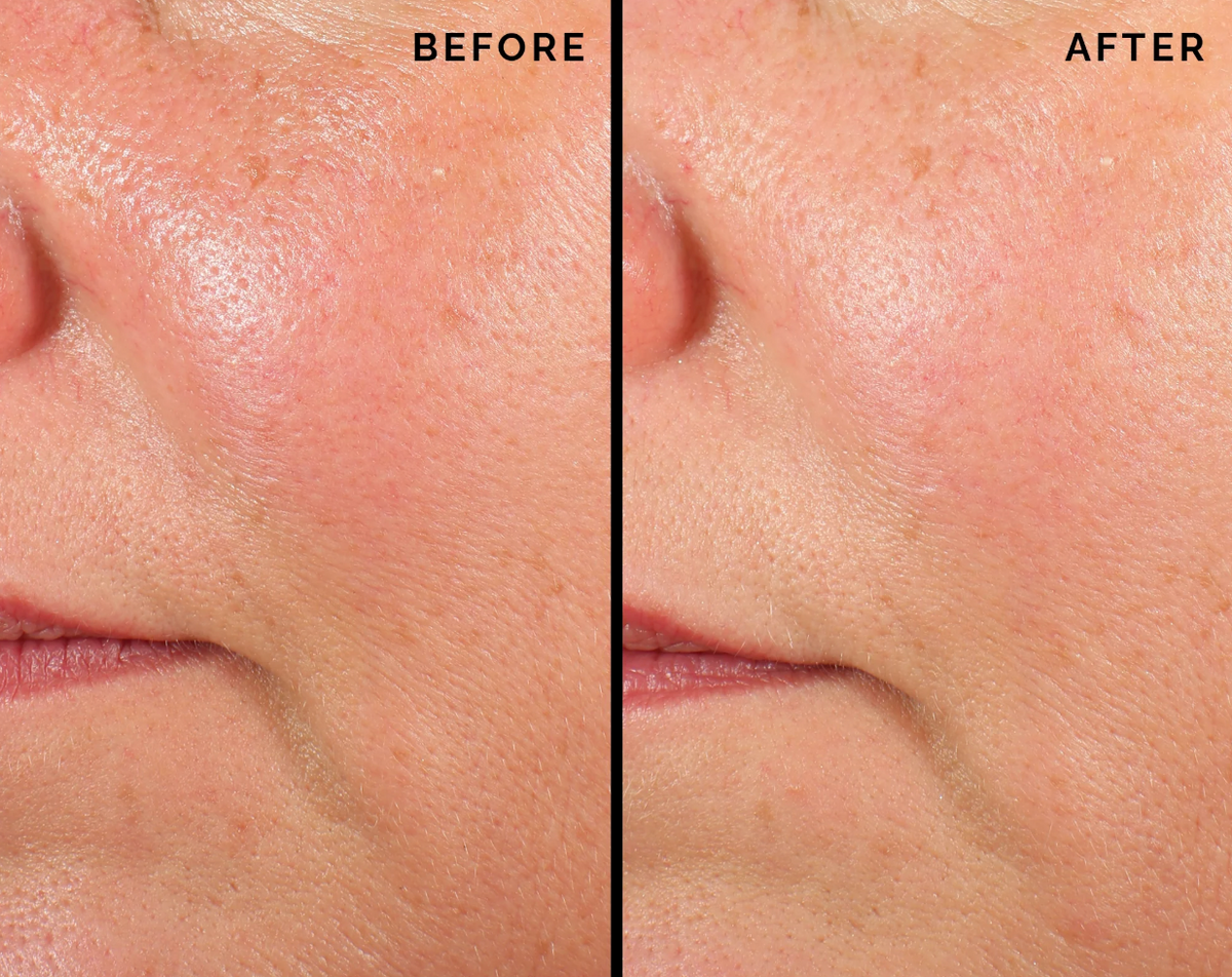 Comfort Zone Skin Regimen Lx Longevity Collagen Serum before en after