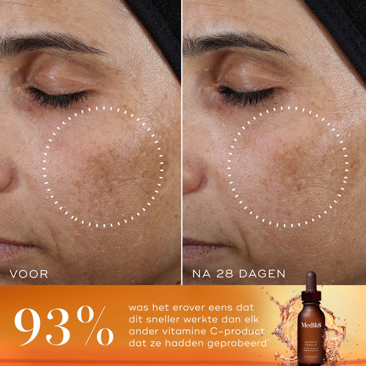 Medik8 Super C Ferulic 30ml résultat avant et après