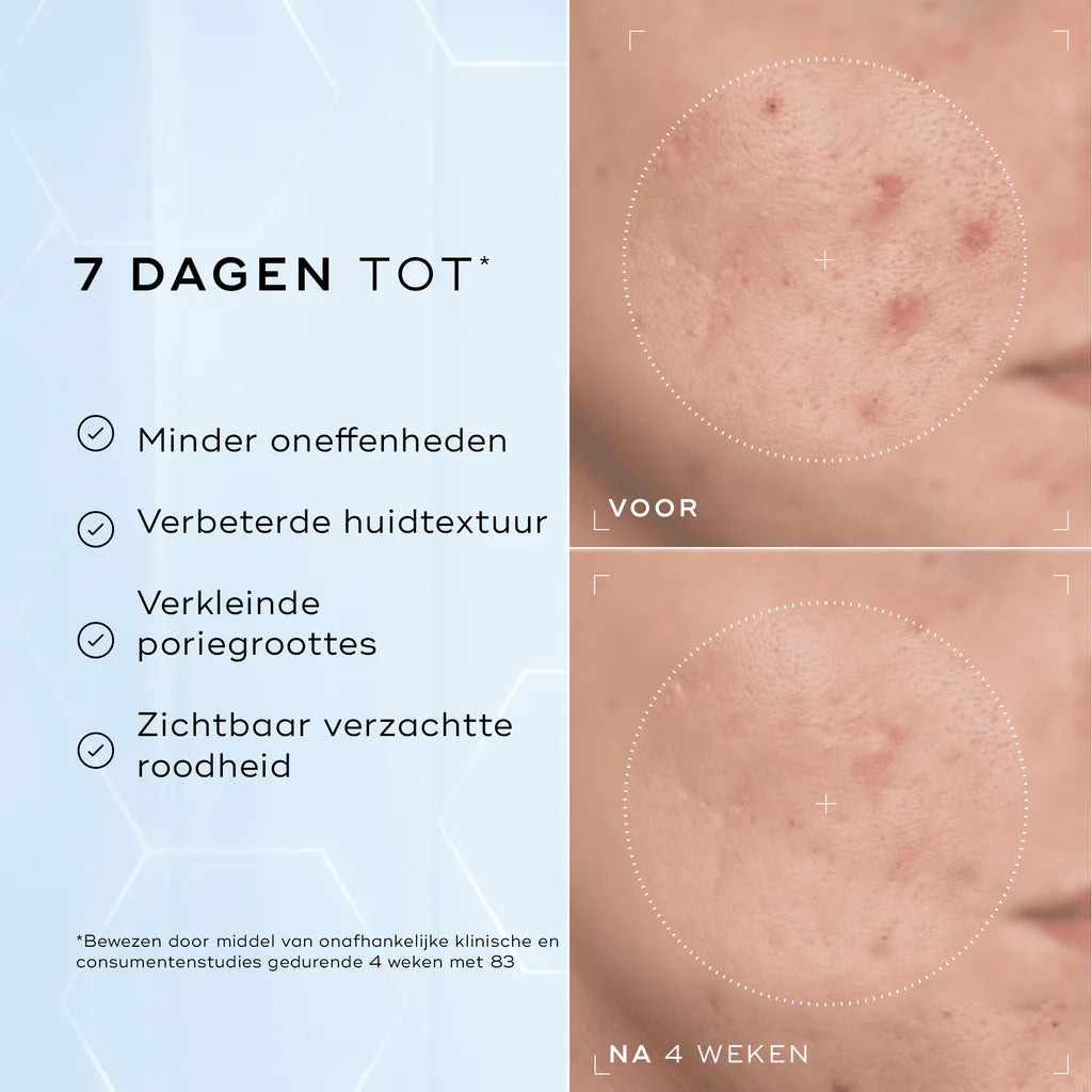 Medik8 Niacinamide peptides 30ml avant et après 4 semaines