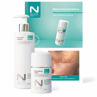 Skin Calming Thuisroutine | Nouvital