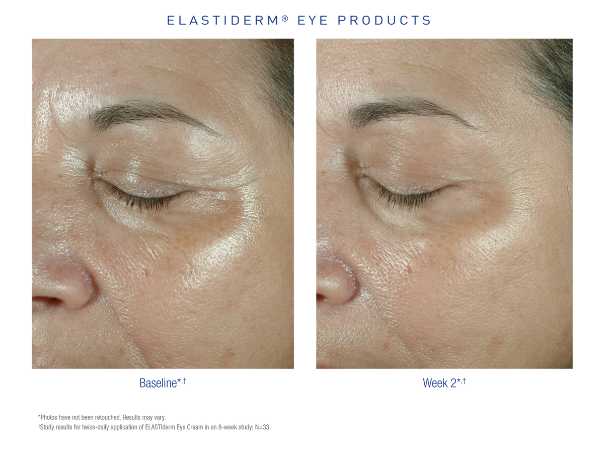 Obagi Elastiderm Eye Cream ambiance