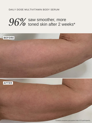 Alpha-H Daily Dose Multi-Vitamin Glow Body Serum bras avant et après
