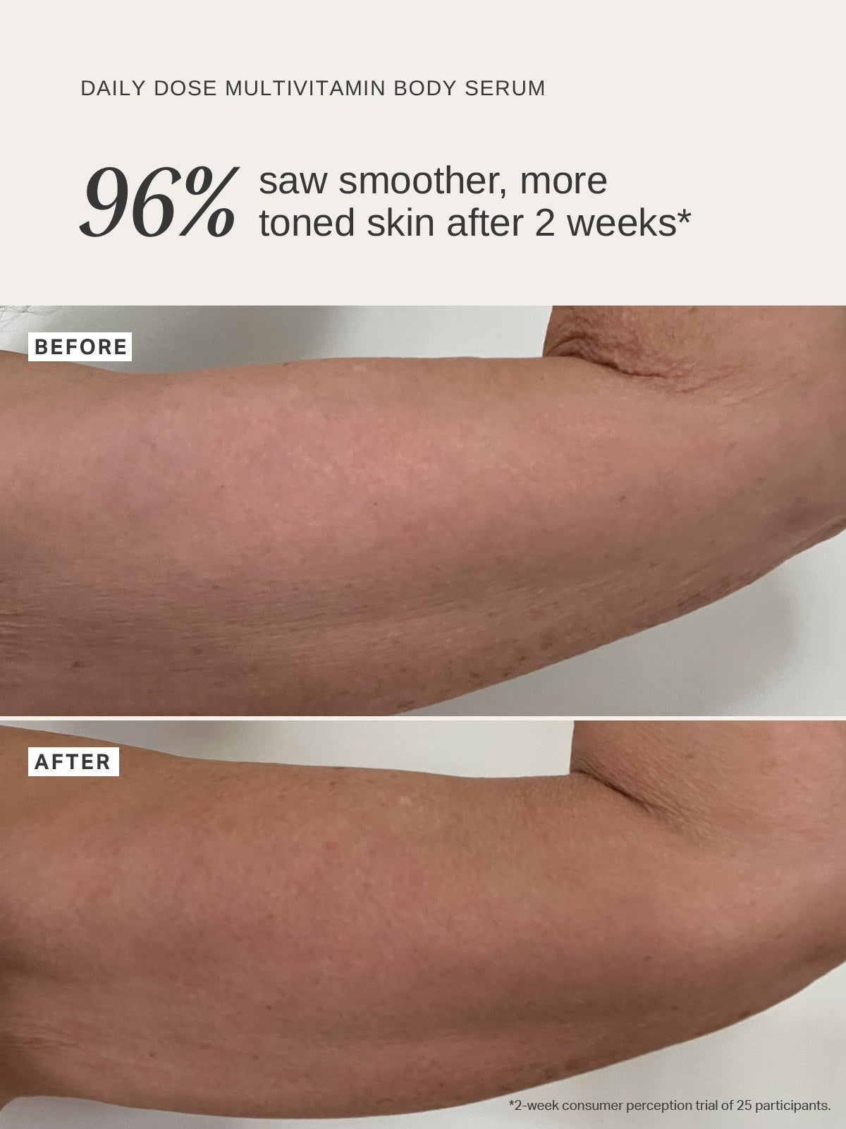 Alpha-H Daily Dose Multivitamin Body Serum bras avant et après
