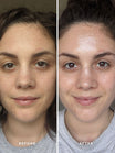 Alpha-H Liquid Gold Exfoliating Treatment avant et après résultat deux