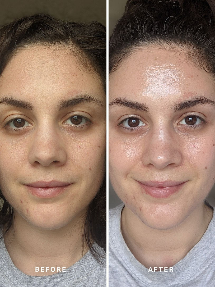 Alpha-H Liquid Gold Exfoliating Treatment avant et après résultat deux