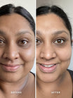 Alpha-H Liquid Gold Exfoliating Treatment avant et après résultat quatre