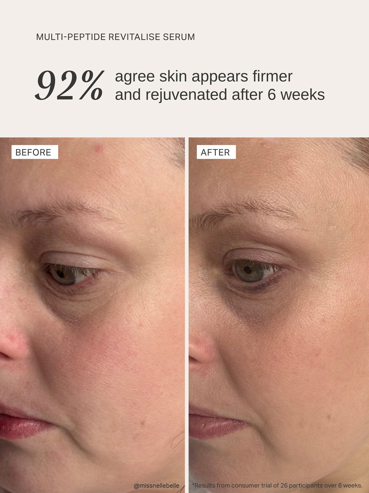 Alpha-H Multi-Peptide Revitalise Serum avant et après résultat trois