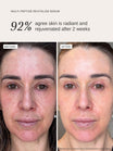 Alpha-H Multi-Peptide Revitalise Serum avant et après résultat deux