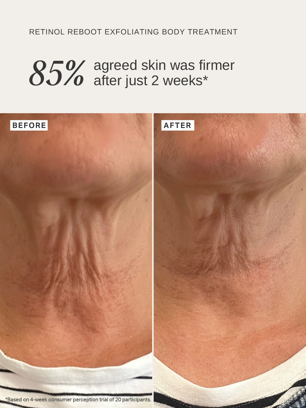 Alpha-H Retinol Reboot Exfoliating Body Treatment avant et après peau plus ferme