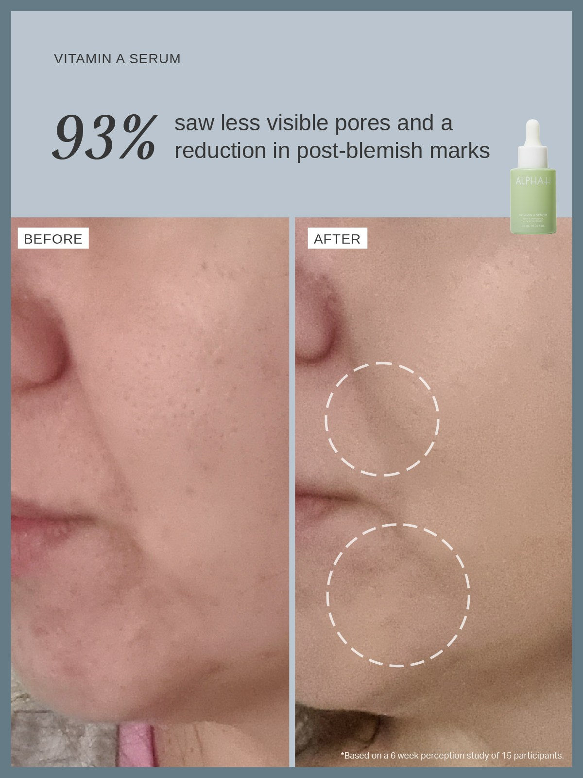 Alpha-H Vitamin A Serum avant et après pores moins visibles