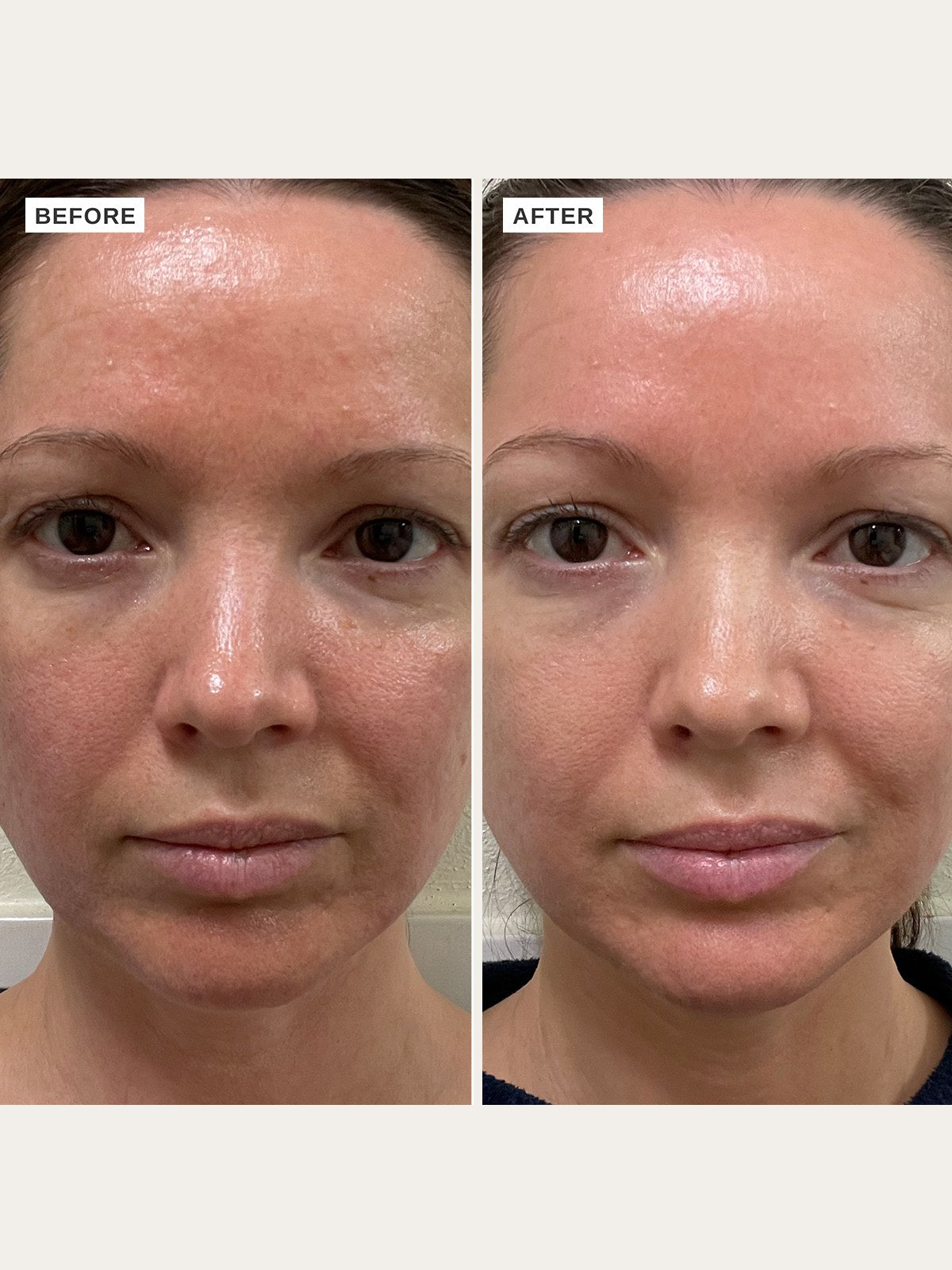 Alpha-H Vitamin B Serum avant et après résultat trois