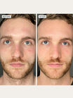 Alpha-H Vitamin B Serum avant et après résultat deux