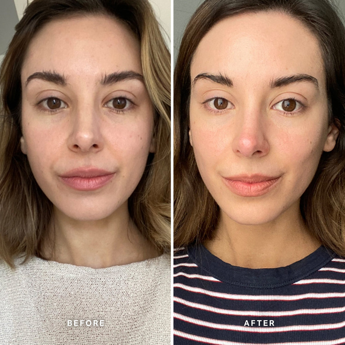 Alpha-H Vitamin C Serum avant et après résultat deux