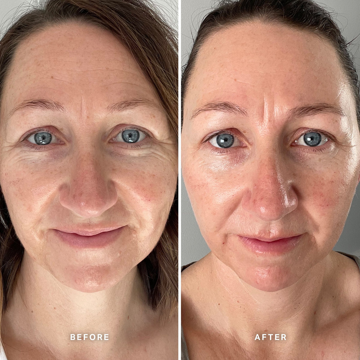 Alpha-H Vitamin E Serum avant et après résultat