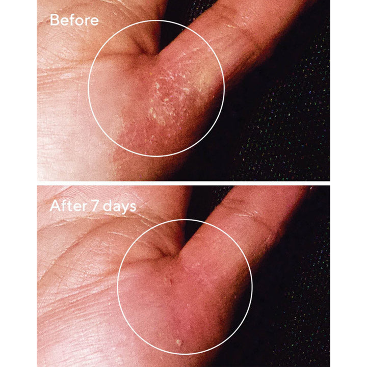 Murad Quick Relief Moisture Treatment avant et après