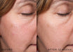 Medik8 r-Retinoate Intense - Night cream avant et après