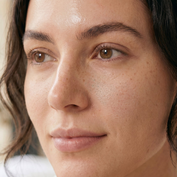 Pores dilatés & teint terne