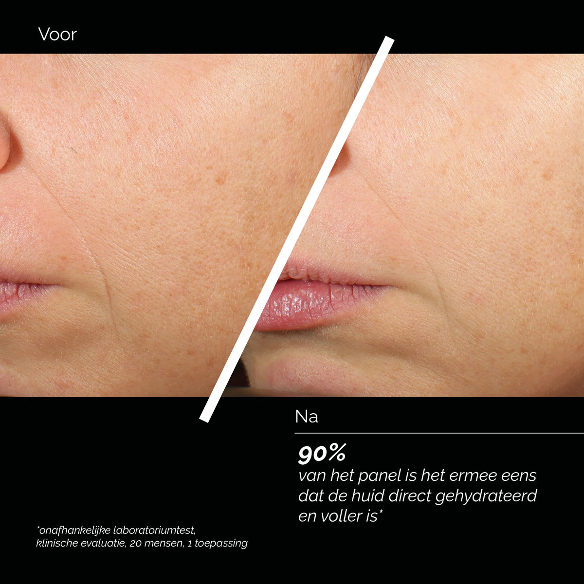 Comfort Zone Skin Regimen Lx HA4 Jelly Serum avant et après