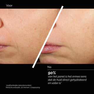 Comfort Zone Skin Regimen Lx HA4 Jelly Serum voor en na